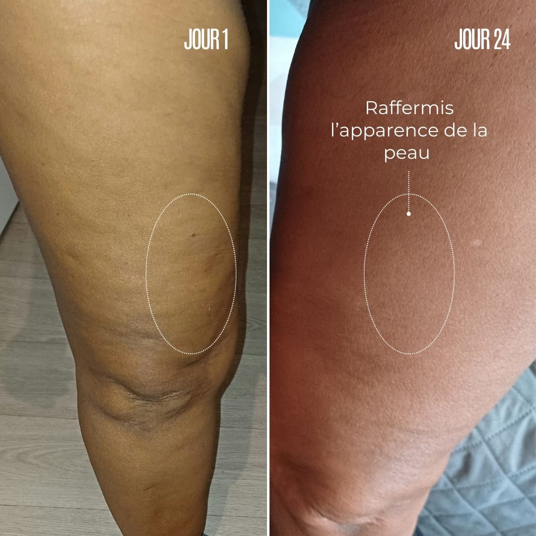 Crème Anti-Cellulite Charm